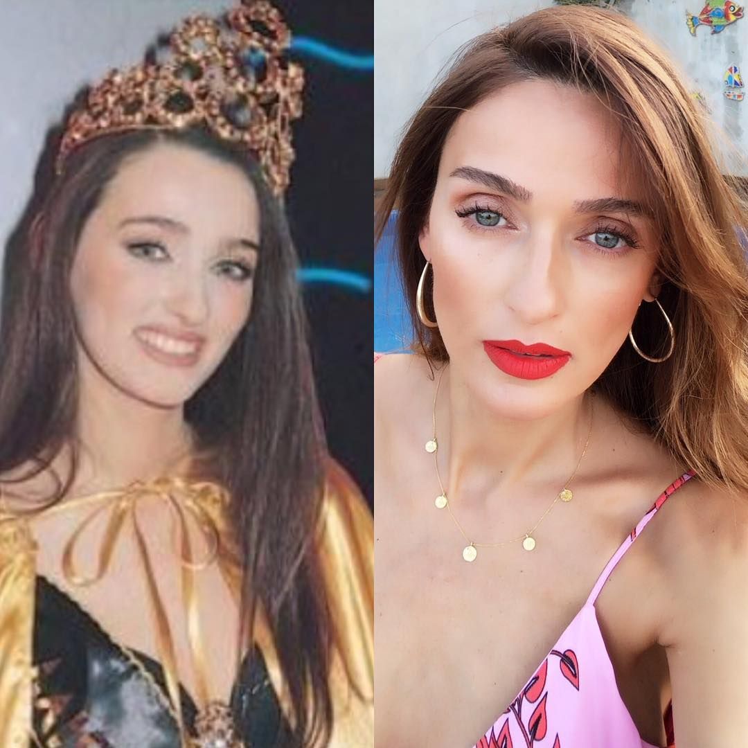 Pınar Altuğdan kaza sonrası ilk açıklama Pınar Altuğdan kaza sonrası ilk açıklama